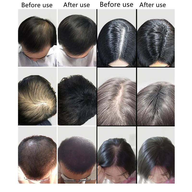 HairFull Pro | Fibras Capilares de Queratina com Spray Aplicador – 9 Cores